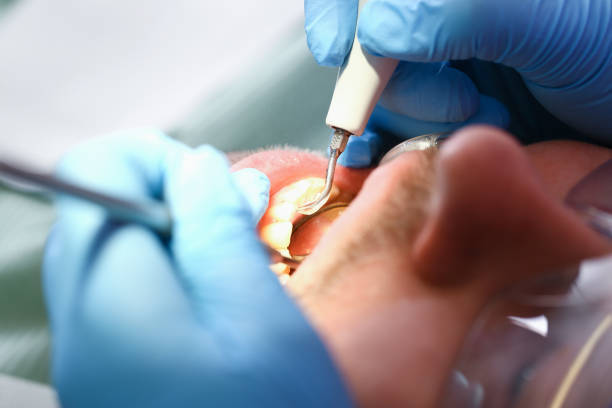 Best Pediatric Emergency Dentist in Hubbard, OR